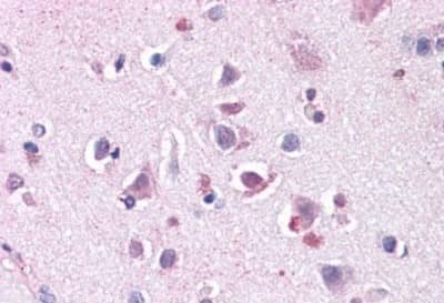 Immunohistochemistry-Paraffin ENT1 Antibody